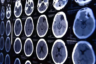 Diagnostik Neurologie und Neuroradiologie