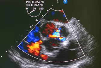 Doppler- und Duplexsonographie