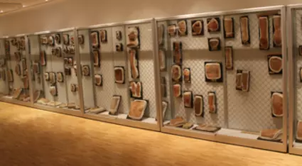 UK Bonn Bonner Moulagensammlung