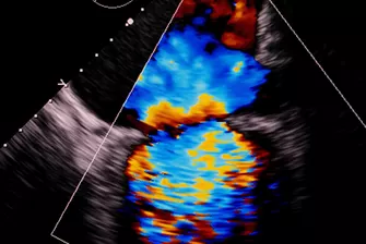 Echokardiographie- und Doppler-Kurs